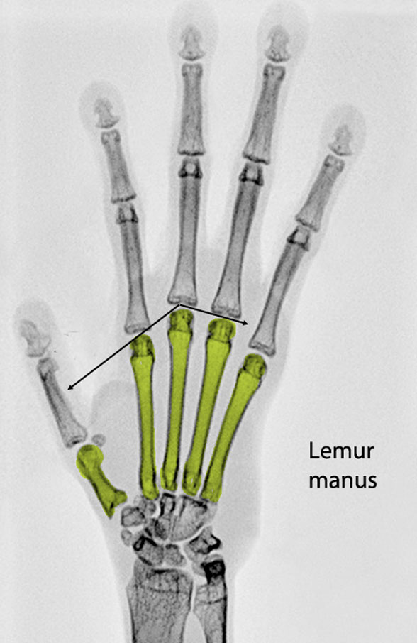 Lemur manus