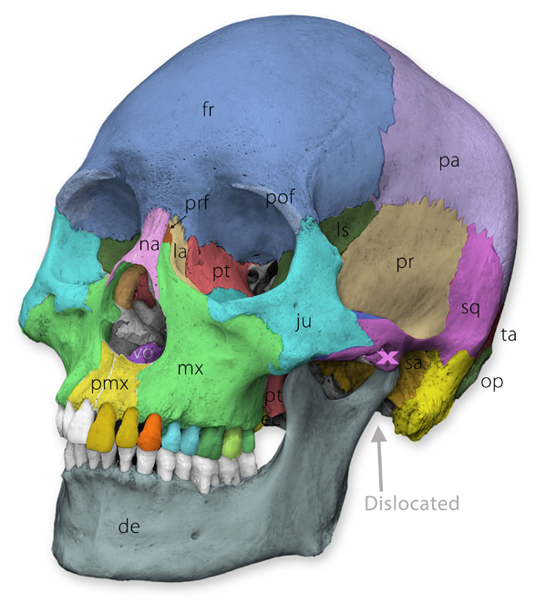 Human_Homo_sapiens