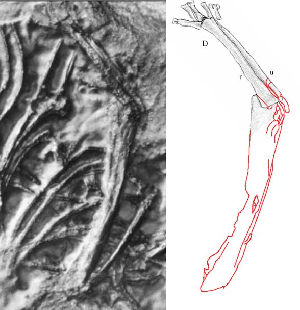 hypuronector elbow